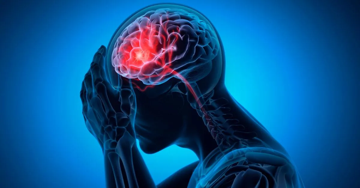 thromotic vs embolic stroke in man's brain