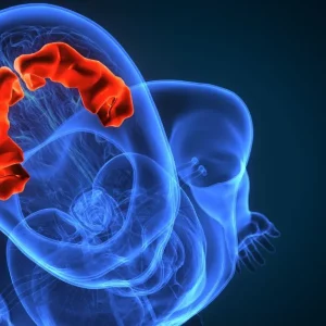 ideomotor apraxia on display