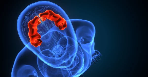 ideomotor apraxia on display