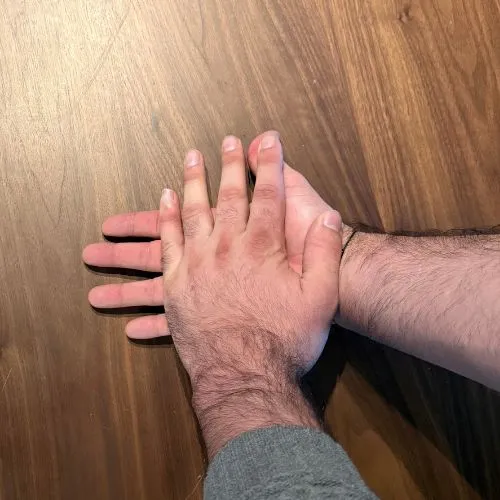 palm open stretch for spasticity after stroke