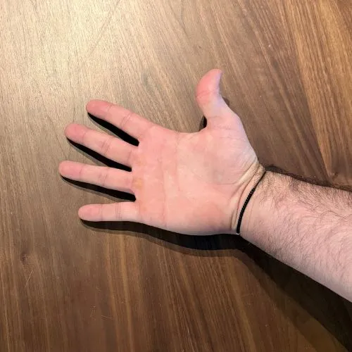 supination for spasticity after stroke