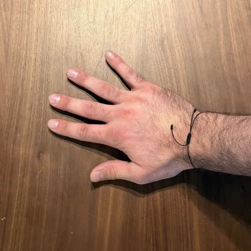 pronation so tretching for spasticity after stroke