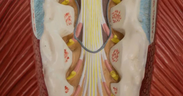 illustration of cauda equina syndrome