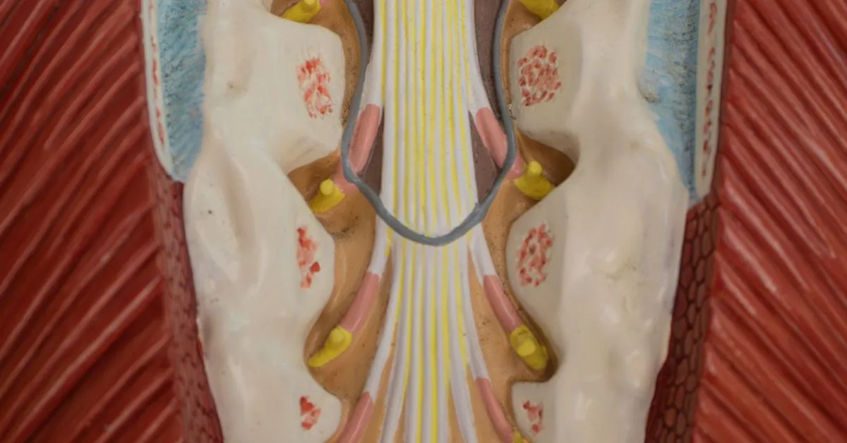 illustration of cauda equina syndrome